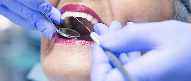 Best Emergency Broken Tooth Repair in Hoboken, NJ